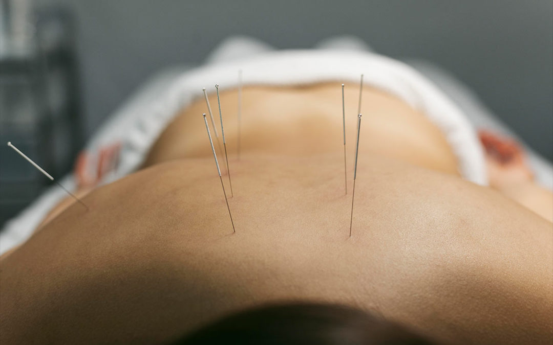 Acupuncture for Pain, Or is There More?